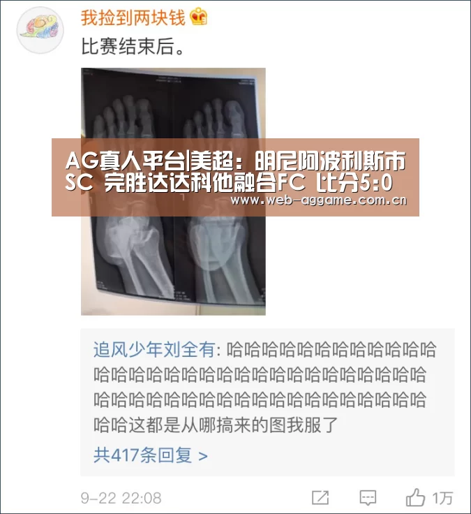 AG真人平台|美超: 明尼阿波利斯市SC 完胜达达科他融合FC 比分5:0 大比分差取胜(图2) AG真人APP
